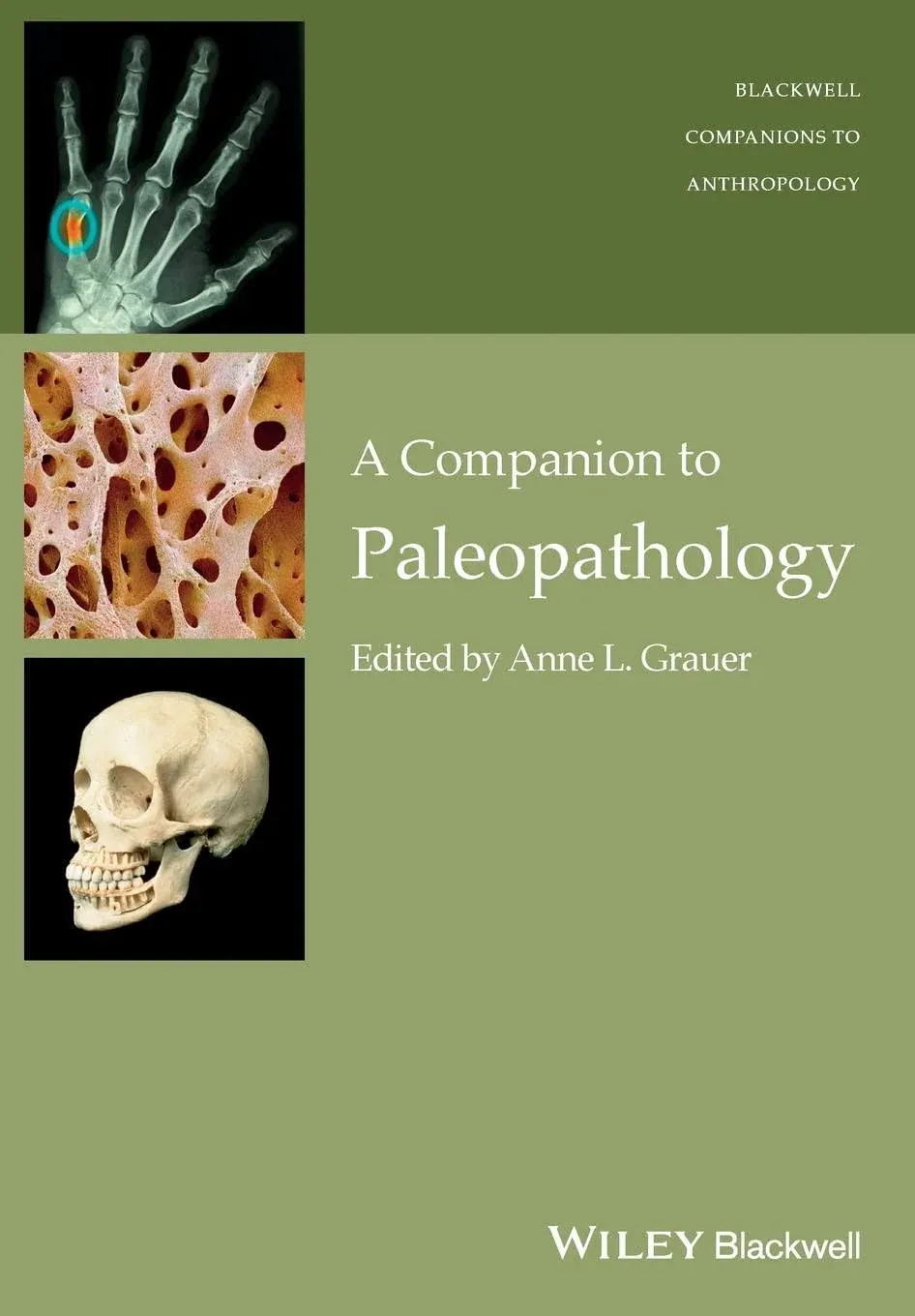 A Companion to Paleopathology (Wiley Blackwell Companions to Anthropology)